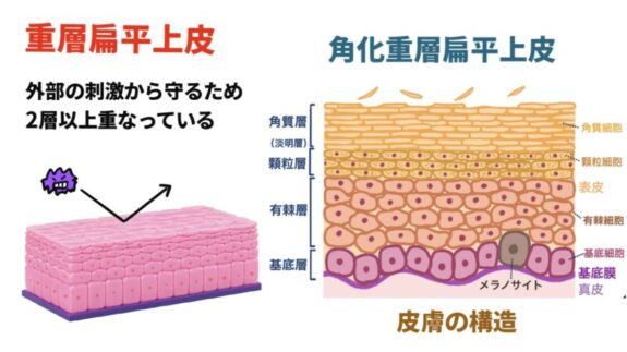 重層扁平上皮